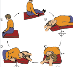 The "Printable:-Zcyatlgu_0= Epley Maneuver Pdf" emerges as an essential tool for both patients and healthcare professionals