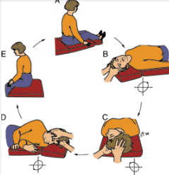 The "Printable:-Zcyatlgu_0= Epley Maneuver Pdf" emerges as an essential tool for both patients and healthcare professionals